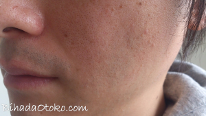 ケノン美顔器の効果を男で検証！美顔器の正しい使い方で肌質改善！